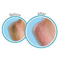 thumbnail image 3 of O'Keeffe's Healthy Feet Exfoliating Cream, 3oz Tube, 3 of 5