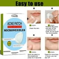 CHOUXI 2 Pack Micropoint Acne Patch, Cystic Acne Patches Efficient