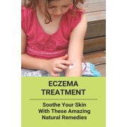 Eczema Treatment : Soothe Your Skin With These Amazing Natural Remedies: Eczema Alternative Treatments (Paperback)
