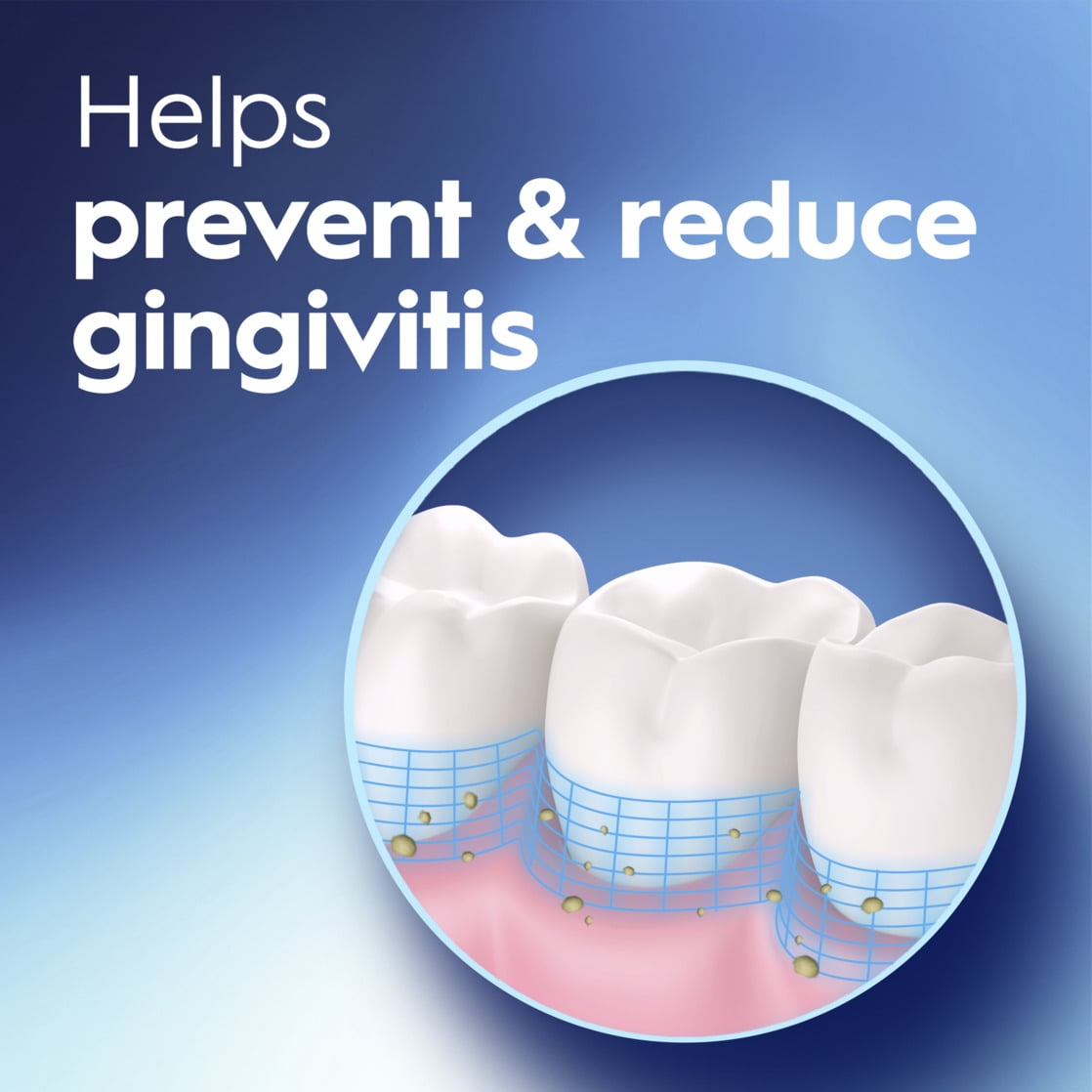 Crest Pro-Health Gum Restore Mouthwash/Mouth Rinse, Antigingivitis/Antiplaque, Clinically Proven, Fights Gum Disease, Alcohol Free, Smooth Mint - 1L (33.8 fl oz)