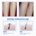 thumbnail image 4 of Venalisa Exfoliating Brush, Prevent Razor Bumps, Eliminate Shaving Irritation For Face, 4 of 5