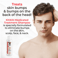 thumbnail image 3 of KitiKiti Medicated Treatment Shampoo with Aloe (8 Fluid Ounces), 3 of 7