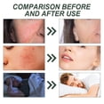 thumbnail image 5 of Aceite de Masaje Hidratante Hidratante Fino y Reafirmante Piel Facial Suaviza y Embellece la Piel 60ml a essence, 5 of 5