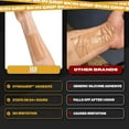 thumbnail image 6 of Skin Grip Medical Grade Silicone Scar Tape 1.6"x120" Roll –Increased Strength & Reduced Irritation – Silicone Scar Sheets for Face, Surgical Scars, C-Section, Keloid, Tummy Tuck, Burn - Skin, 6 of 7
