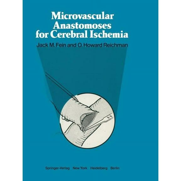 Microvascular Anastomoses for Cerebral Ischemia, (Paperback)