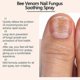 thumbnail image 3 of 3X Bee Venom Nail Repair Serum, Nail Care Solution, Natural Bee Venom Nail Care Spray, Ingrown Toenail Care Spray, 3 of 5