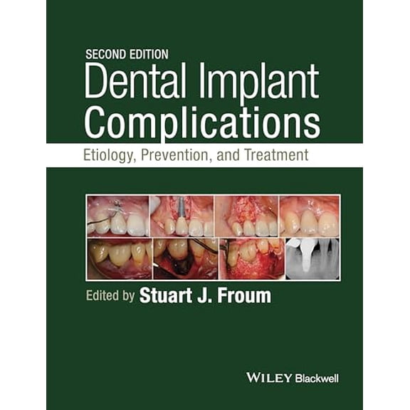 Pre-Owned Dental Implant Complications: Etiology, Prevention, and Treatment