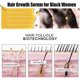 thumbnail image 4 of Sérum para el crecimiento del cabello para mujeres y hombres afroamericanos, cabello más grueso y abundante, nutre el cuero cabelludo, 3 piezas, 4 of 5