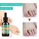 thumbnail image 3 of Solución líquida antimicótica para uñas de 30ml para uñas de manos y pies, 3 of 5