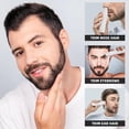 thumbnail image 5 of Nose and Ear Hair Trimmer Clipper, Professional Nose Hair Trimmer for Men, Easy to Clean (White) Battery Not Included, 5 of 5
