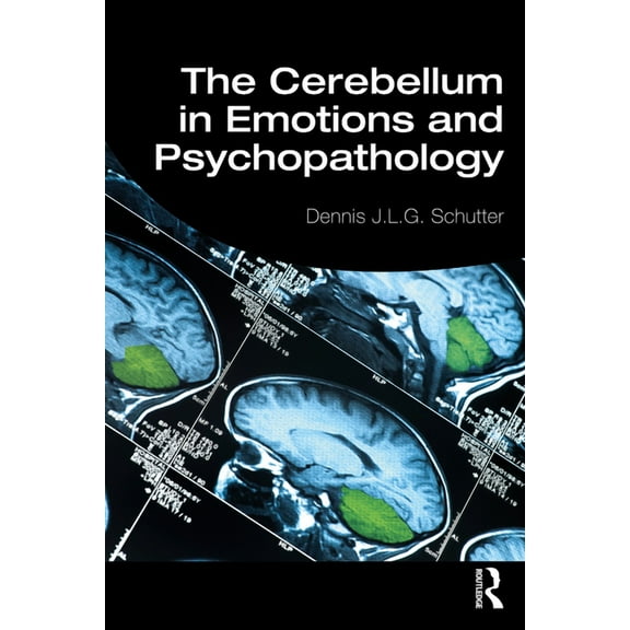 The Cerebellum in Emotions and Psychopathology, (Paperback)