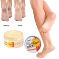thumbnail image 2 of Xihbxyly Crema para Piel Agrietada, Crema Terapéutica Avanzada para Manos, Tratamiento Hidratante para Pies, Fórmula Reparadora de Rápida Absorción, Uso Diario para Piel Seca, Ideal para El Cuidado I, 2 of 7