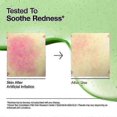 thumbnail image 2 of 1/2/3x Anua Acid 10 Hyaluron Redness Soothing Serum Facial Spot Care 30ml 1oz, 2 of 5