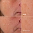 thumbnail image 3 of Sérum Clinique Even Better Clinical Dark Spot, 50 ml, con vitamina C, 3 of 9