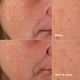 thumbnail image 3 of Sérum Clinique Even Better Clinical Dark Spot, 50 ml, con vitamina C, 3 of 9