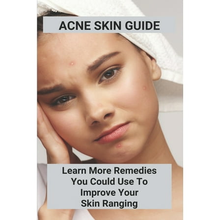 Acne Skin Guide: Learn More Remedies You Could Use To Improve Your Skin Ranging: Acne Under Skin (Paperback)