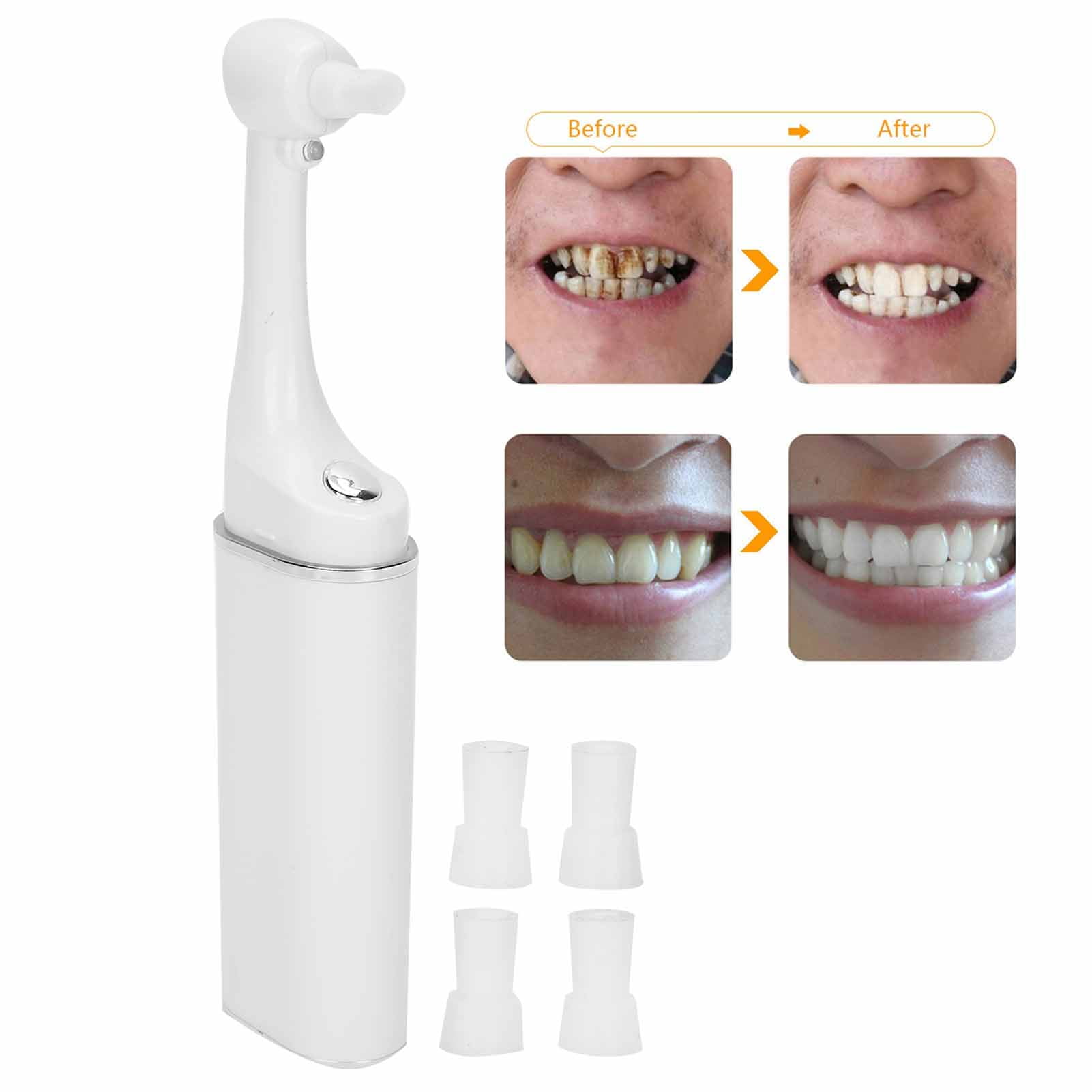 FTVOGUE Tooth Polisher Cleaning Tool,Electric Tooth Polisher Stain ...