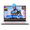 Rose Gold, variant on 15.6" IPS FHD Gaming Laptop 16GB DDR5 RAM 512GB SSD AMD Ryzen 7 8745HS (8 Cores Up to 4.9GHz Beat R9 7940HS) with Radeon 780M Graphics 100W Type-C Backlit Keyboard Fingerprint Black