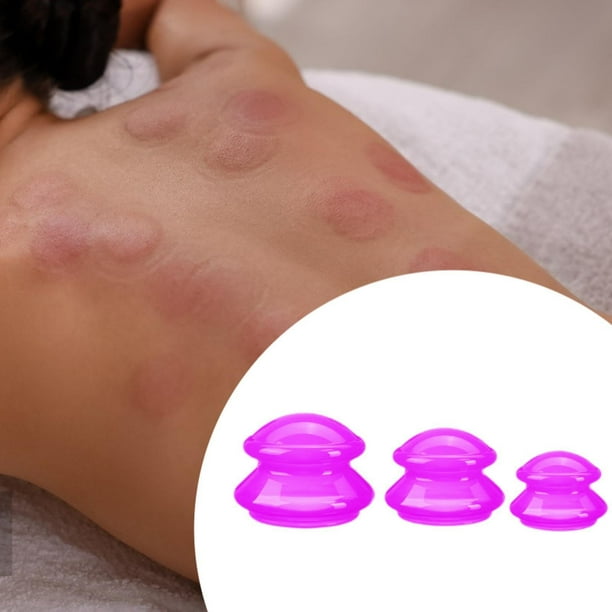 3x Tazas de Chino Ventosas de Vacío Profesionales jinwen para