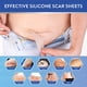 thumbnail image 4 of Rollo de cinta de gel para cicatrices,CAIXIN parche de silicona para eliminar cicatrices sin dolor para cirugía cesárea cicatrices queloides para hombres y mujeres, 4 of 5