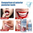 thumbnail image 3 of 1-3pcs Temporary Tooth Repair Moldable Fix Broke Gap Teeth False Teeth Solid Glue 30ml, 3 of 4
