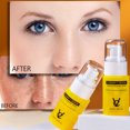 thumbnail image 1 of Blanqueador de pecas firme Xihbxyly vitamina C 30 ml, 1 of 7