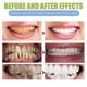 thumbnail image 3 of Gel regenerador dental probiótico Sincero, 3 of 5