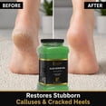 thumbnail image 4 of FOOT SPA4 Scrub Gel Bucket, 4 of 7