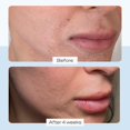 thumbnail image 2 of Crema hidratante First Aid Beauty Ultra Repair, 355 ml, 2 of 9