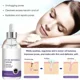 thumbnail image 5 of Esencia Facial para aliviar la sequedad, Control de Aceite hidratante, 5 of 5