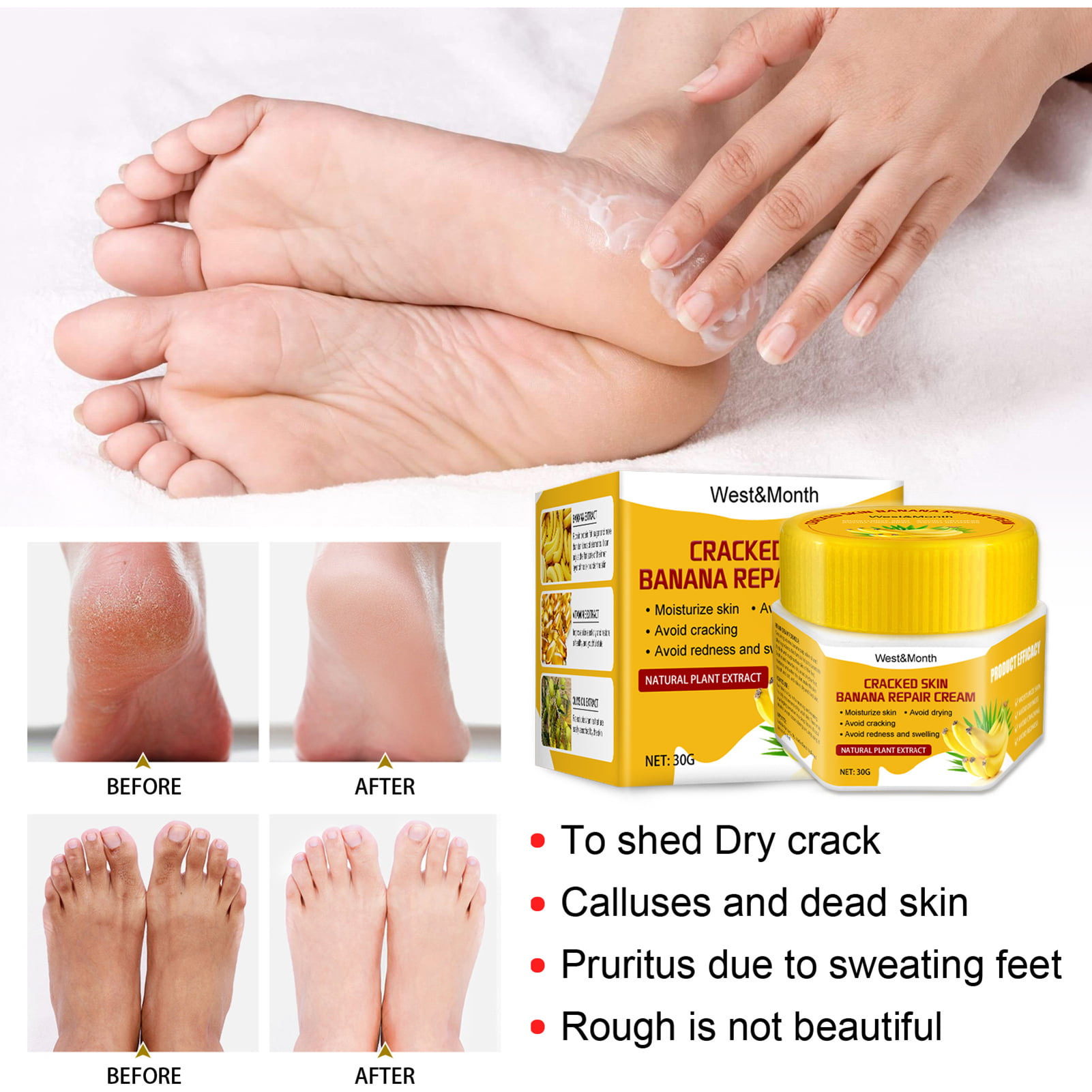 Krack Heel Repair Cream 50gm: Uses, Price, Dosage, Side Effects,  Substitute, Buy Online