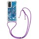 thumbnail image 5 of Funda FOXDOCK para Xiaomi Redmi Note 11/11s 4G con Cuerda Ajustable, Brillo Líquido, Protección Antigolpes y Lente – Ideal para Regalo, 5 of 6