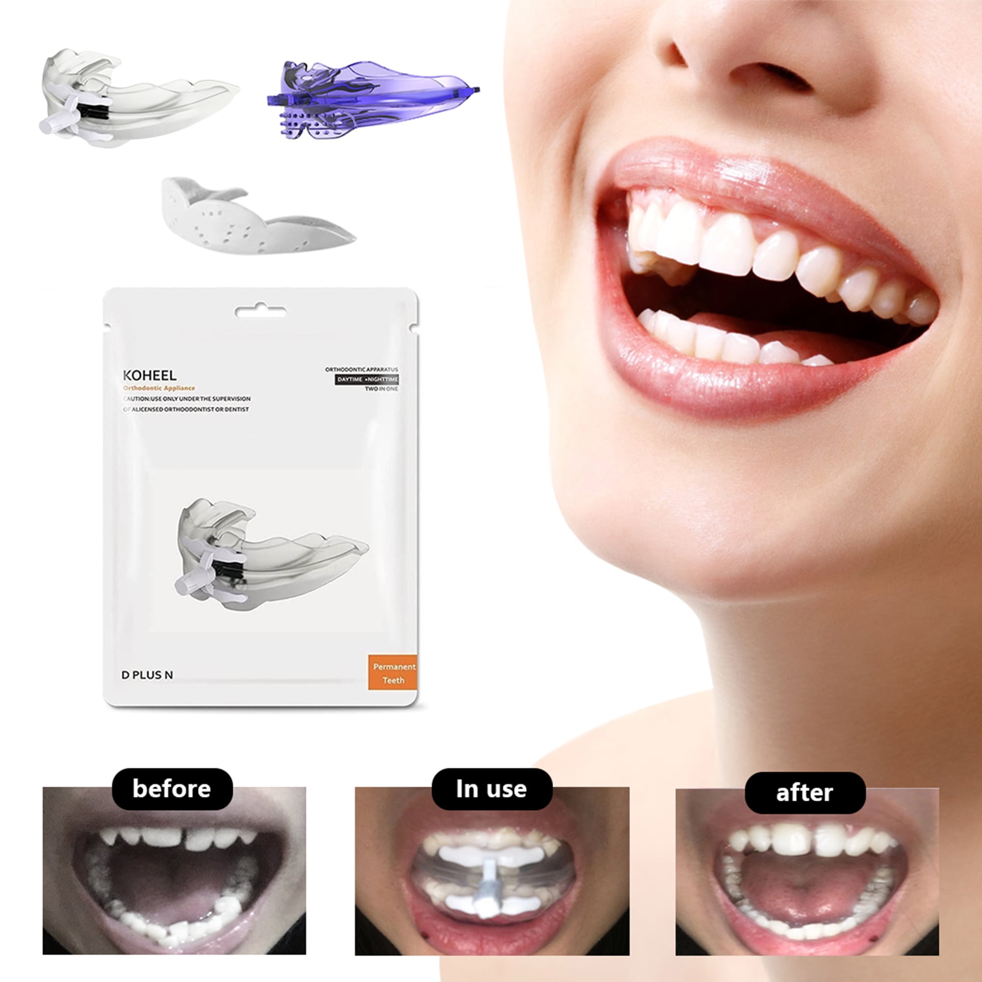 KOHEEL D PLUS N Teeth Straightener for Adults, for a Confident Smile