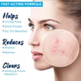 thumbnail image 2 of Amire Blemish Drying Lotion, Acne Spot Treatment Skincare Formula for Teens and Adults, Pink Lotion Dries Out Pimples, Blemishes, Zits, and Clogged Pores, 2 of 6