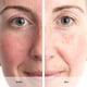 thumbnail image 5 of Serum ANEW Renovador Anti-Edad 30 ml Youthful Glow, 5 of 6