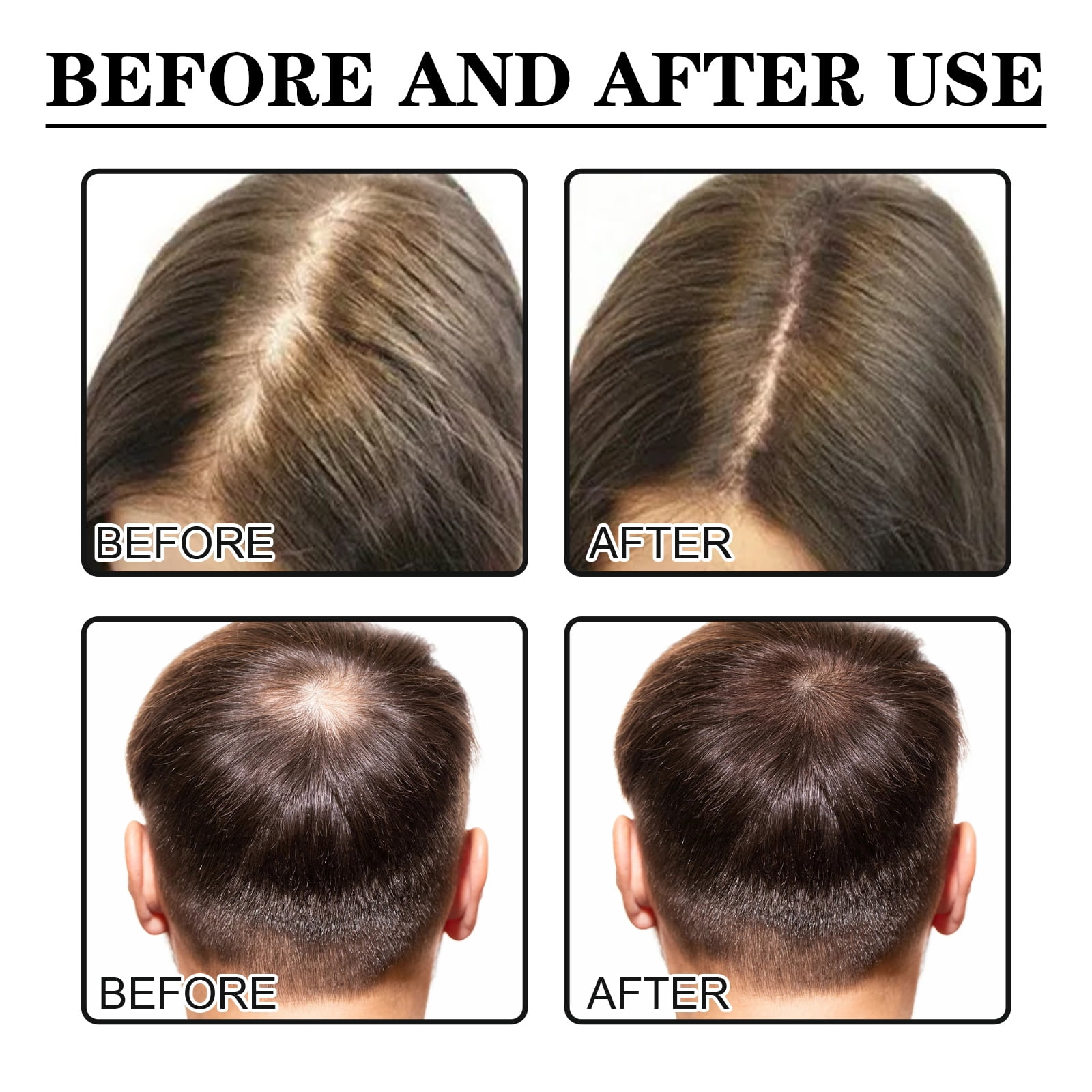 Alvantor Hair Growth and Scalp Nourishment Serum for Damaged Hair, 1 fl oz