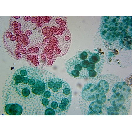 Microscope Slide  Volvox  Asexual  Reproduction W.M. Colonial Algae showing Daughter Colonies price history on PriceWatchPro