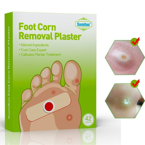 Corn Paste Removes Corns, Blisters, And Feet Corns Removal Original