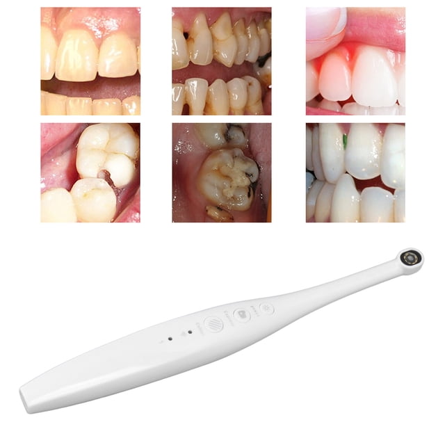 Cámara Oral WiFi ANGGREK Cámara Dental Visual Multifunción Tipo C