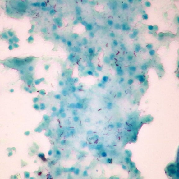 Mycobacterium Tuberculosis, W.M. Microscope Slide