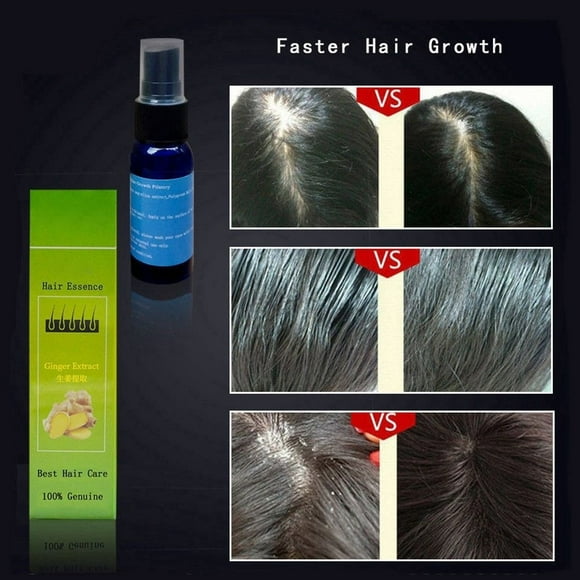 Suero para el crecimiento del cabello BuyWeek 30 ml anticaída Cuidado del cabello