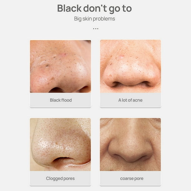 3pcs Lanbena Blackhead Remover Crème Facial Nez Masque Plante Pore Strips  Acné Peel Off
