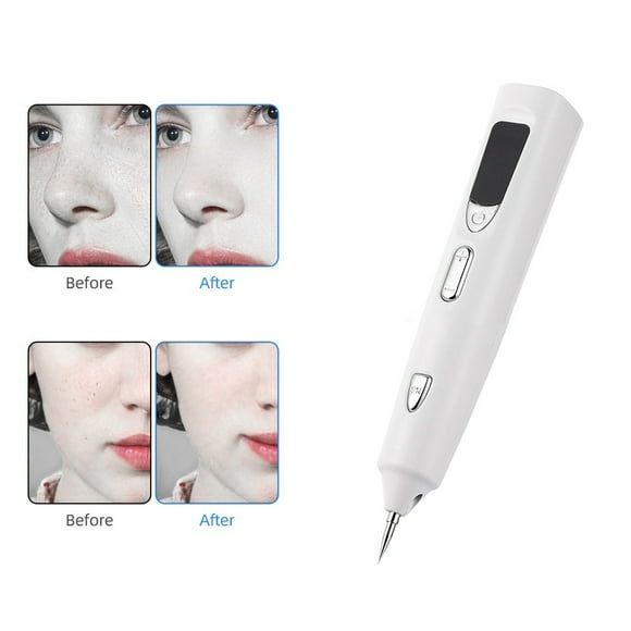 Fiudx Lápiz Removedor de Luz Azul Recargable, Herramienta Portátil para Rostro y Cuerpo, Regalo Ideal, Lápiz Electrónico para Eliminar La Piel Del Rostro, Máquina de Belleza Reparadora Eléctrica