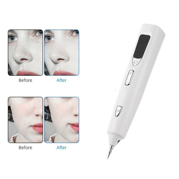 Lápiz removedor de luz azul recargable, herramienta portátil para rostro y cuerpo, regalo ideal, lápiz electrónico para la eliminación de imperfecciones faciales, máquina de belleza reparadora, embell