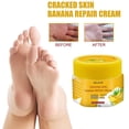 thumbnail image 1 of Aceite de plátano naturalcrema antigrietas para pieseliminación de piel muertacuidado de manos y pies Ndcxsfigh  Cuidado Belleza, 1 of 5