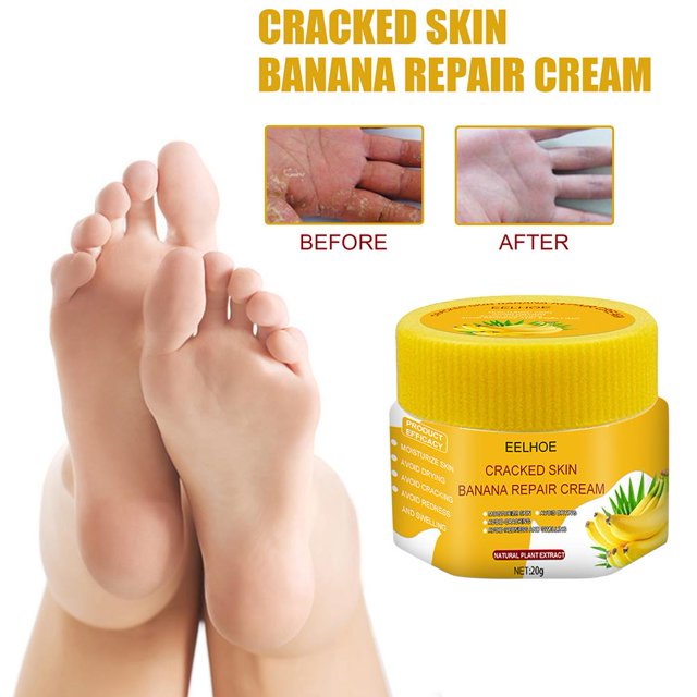 Aceite de plátano naturalcrema antigrietas para pieseliminación de piel muertacuidado de manos y pies Ndcxsfigh Cuidado Belleza