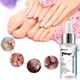 thumbnail image 4 of Líquido reparador de uñas de 20 ml Líquido eficaz para tratamiento de uñas Multiusos para el cuidado de los pies, 4 of 9