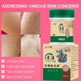 thumbnail image 4 of Crema reparadora de piel de pollo, loción de suero suave hidratante, elimina los poros gruesos, elimina las manchas oscuras del cuerpo, queratosis, folículo Pilaris, 4 of 5