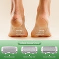 thumbnail image 2 of Wiher Electric Foot Callus Remover, LED Light & Display Electric Foot File, Waterproof Electric Foot Filer, 3 Replacement Rollers & USB-C Charging Foot Sanders for Feet White, 2 of 7