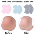 thumbnail image 4 of Calcetines de gel hidratante con ventilación para el talón, 3 pares de calcetines de spa sin dedos para el tratamiento del cuidado de los pies, talones agrietados, pies secos (gris, verde, r, 4 of 5